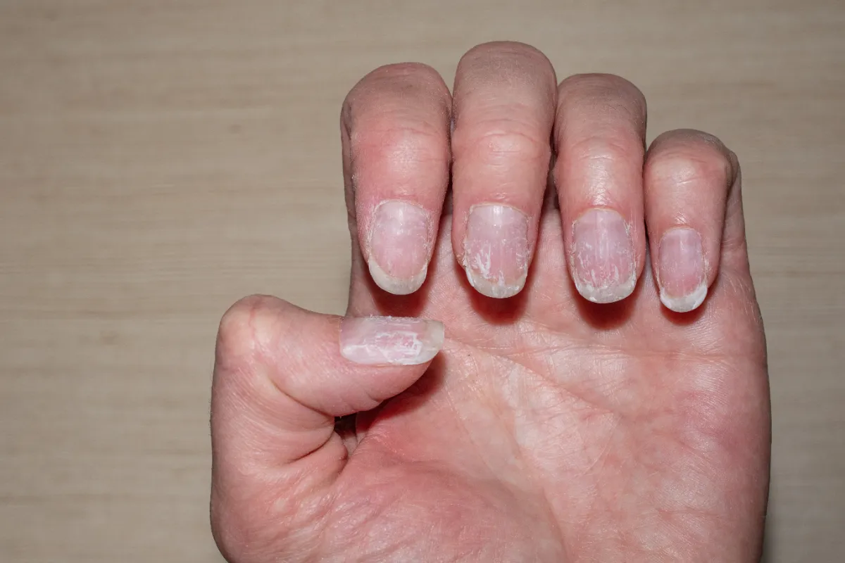 Hoe je broze nagels na zomermanicures weer gezond maakt